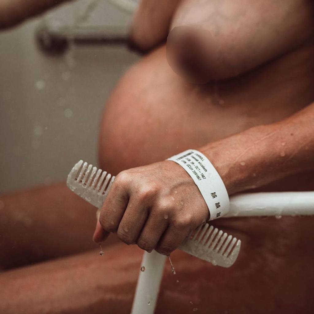 Reflexzonenkamm für die Geburt