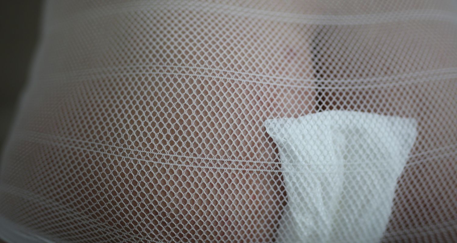 Geburtsverletzungen: Vorbeugung und Wundheilung